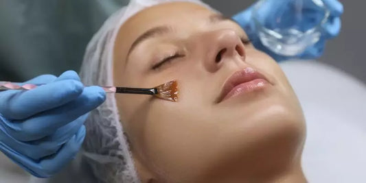 How Chemical Peels Can Transform Your Skin